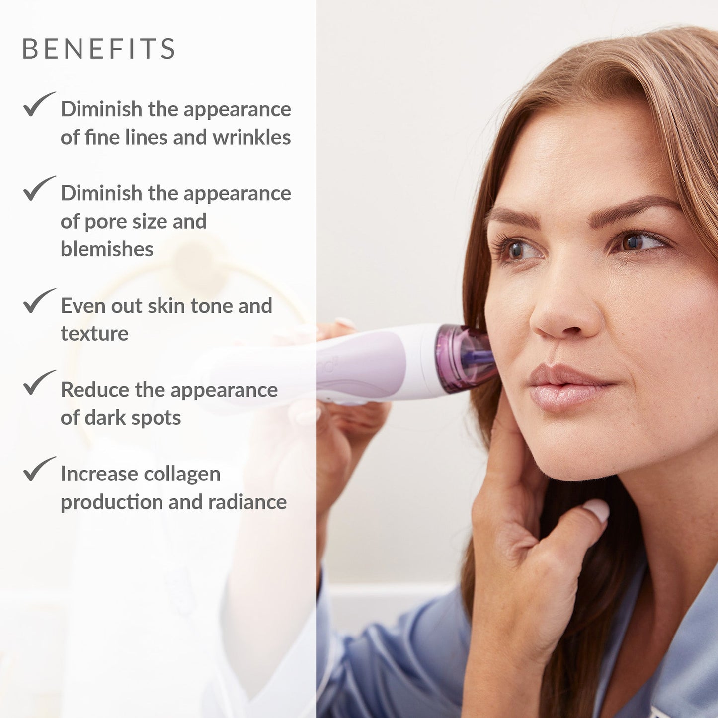 Personal Microderm Pro - International