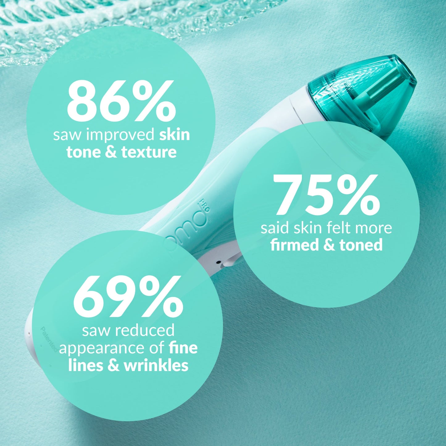 Personal Microderm Pro - International