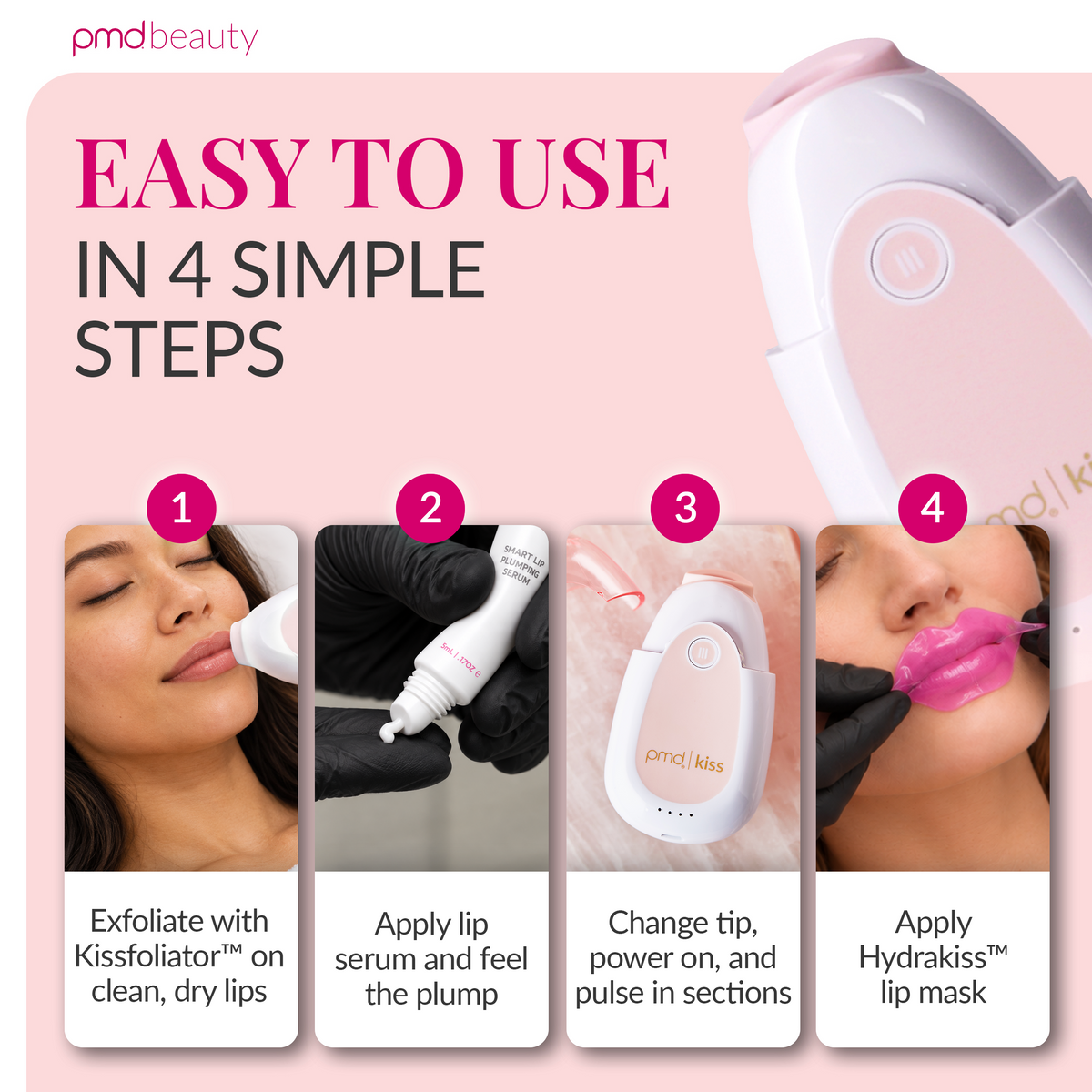 PMD Kiss System